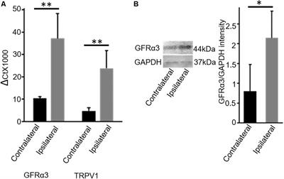 Correlation of Artemin and GFRα3 With Osteoarthritis Pain: Early Evidence From Naturally Occurring Osteoarthritis-Associated Chronic Pain in Dogs